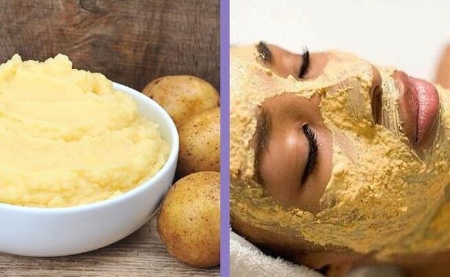 قناع البطاطس
